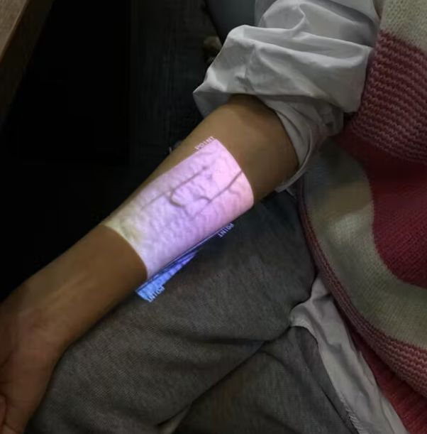 Hellovein LITE 2.0 Portable Vein Finder