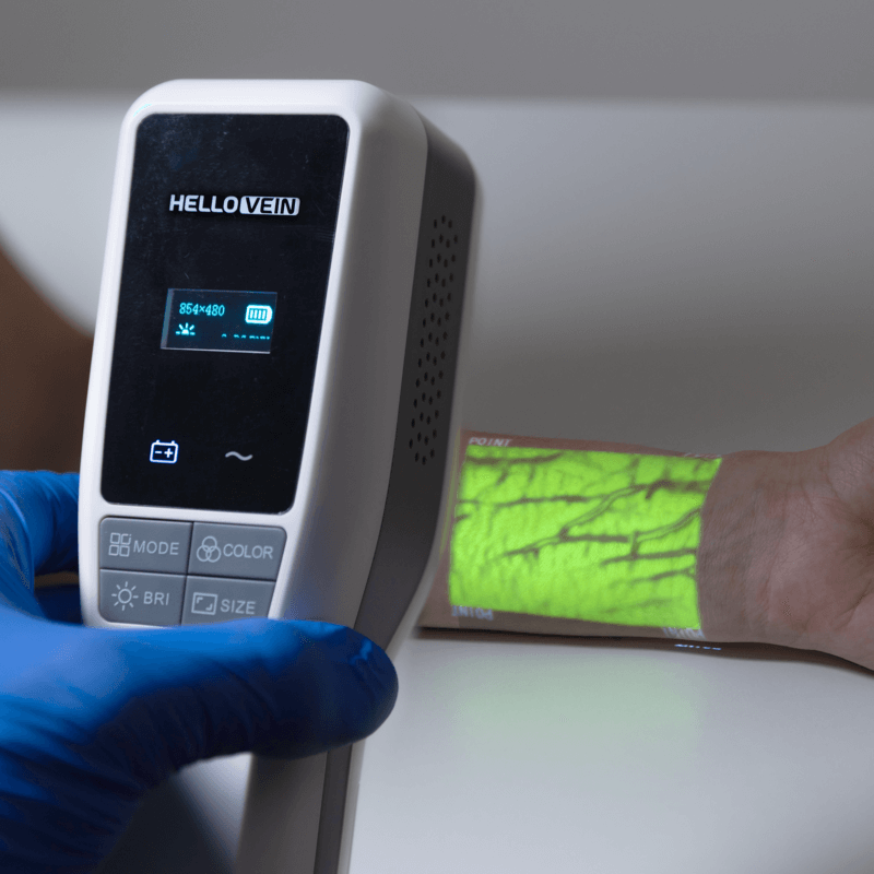 Hellovein LITE 2.0 Portable Vein Finder