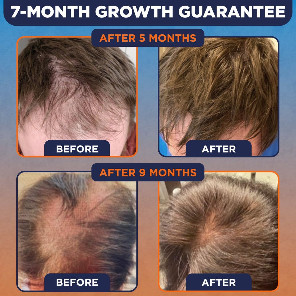 Kiierr FDA-Approved Laser Cap System for Hair Growth